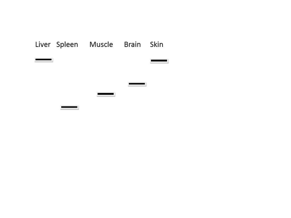   Northern blot analysis can be used to determine the relative amount and size of different RNA transcripts. Above is a representation of a northern blot analysis of several different tissues for the expression of a single gene. Which of the following statements is correct? A)  Some of the samples contain incompletely processed mRNA B)  Some of the samples contain pre-mRNA C)  The mRNA is differentially spliced D)  All tissues express identical proteins