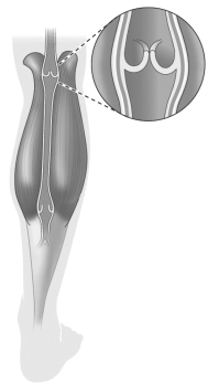 The structure depicted in the figure below (enlarged to give you a better view) uses muscles to open and close in response to the pull of gravity.   