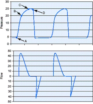 Identify the plateau pressure (P<sub>plateau</sub>) for the pressure-controlled continuous mandatory ventilation (PC-CMV) breaths in the figure.   A)  Point A B)  Point B C)  Point C D)  Point D