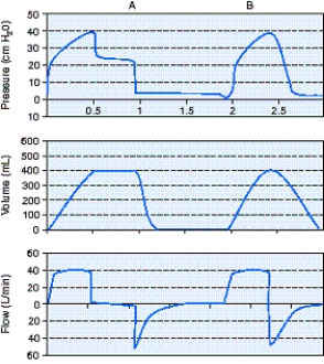 Calculate the static compliance using the information from the scalar below.   A)  10 mL/cm H<sub>2</sub>O B)  16 mL/cm H<sub>2</sub>O C)  20 mL/cm H<sub>2</sub>O D)  80 mL/cm H<sub>2</sub>O