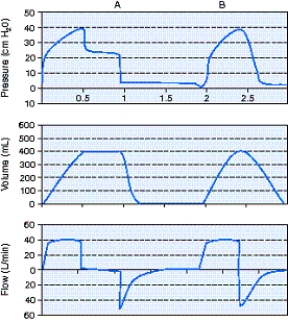 <strong>What is the inspiratory time for the ventilator breath shown in section B of the figure below?  </strong> A) 0.5 seconds B) 1.0 seconds C) 1.5 seconds D) 2.0 seconds <div style=padding-top: 35px> 