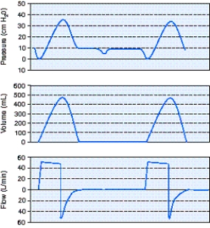 Identify the improperly set ventilator parameter using the scalars shown below.   A)  Mode B)  Flow rate C)  Sensitivity D)  Tidal volume