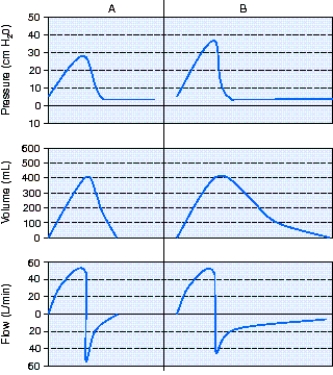 <strong>A patient is receiving full ventilatory support with volume ventilation.At 0700 the respiratory therapist observes the pressure-,volume-,and flow-time scalars shown in A below.Six hours later the respiratory therapist observes the scalars shown in B. The most appropriate action to take is which of the following?  </strong> A) Increase the positive-end-expiratory pressure (PEEP)level. B) Check the circuit for a leak. C) Administer a bronchodilator. D) Switch to pressure ventilation. <div style=padding-top: 35px> 