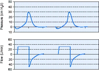 <strong>The respiratory therapist observes the following pressure-time and flow-time scalars following a patient being intubated and placed on a mechanical ventilator using volume ventilation.The most appropriate action is which of the following?  </strong> A) Increase the set flow rate. B) Switch to pressure control. C) Increase the set tidal volume. D) Change to a decelerating flow pattern. <div style=padding-top: 35px> 