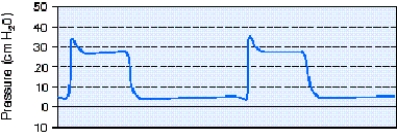 During pressure-controlled continuous mandatory ventilation (PC-CMV) the respiratory therapist observes the pressure-time scalar shown below.The most appropriate action to take is which of the following?   A)  Adjust the inspiratory time. B)  Increase the flow rate setting. C)  Adjust the inspiratory rise time control. D)  Increase the peak inspiratory pressure setting.