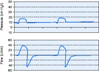 What is the flow-cycle setting for the pressure support ventilation (PSV) breaths shown in the scalars below?   A)  10% B)  25% C)  40% D)  50%