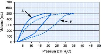 What is the cause of the change from pressure-volume loop A to pressure-volume loop B during volume-controlled continuous mandatory ventilation (VC-CMV) ?   A)  Decreased compliance B)  Increased compliance C)  Decreased airway resistance D)  Increased airway resistance