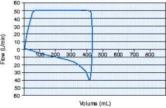 <strong>A patient is receiving ventilation with volume-controlled continuous mandatory ventilation (VC-CMV).During a patient-ventilator system check the respiratory therapist sees the flow-volume loop below.The most appropriate action is to do which of the following?  </strong> A) Add positive-end-expiratory pressure (PEEP). B) Switch to pressure-controlled continuous mandatory ventilation (PC-CMV). C) Administer a bronchodilator. D) Check the endotracheal (ET)tube cuff pressure. <div style=padding-top: 35px> 