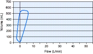 The type of breath shown in the flow-volume loop below is which of the following?   A)  Pressure support ventilation (PSV)  B)  Continuous positive airway pressure (CPAP)  C)  Pressure-controlled continuous mandatory ventilation (PC-CMV)  D)  Spontaneous without support