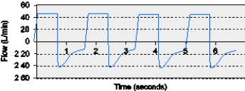 The RT assesses the flow-time scalar from an apneic patient mechanically ventilated in the VC-CMV mode.The most appropriate action for this patient is to do which of the following?   A)  Decrease the set flow rate. B)  Reduce the set ventilator rate. C)  Increase the inspiratory time. D)  Decrease the set tidal volume.