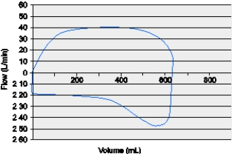 An intubated patient is receiving mechanical ventilation with the following settings: VC-CMV,rate = 18,V<sub>T</sub> = 850 mL (10 mL/kg) ,PEEP = 5 cm H<sub>2</sub>O,flow rate = 40 L/min.The patient is sedated and is not assisting the ventilator.During a patient-ventilator system check,the respiratory therapist observes the following ventilator graphic:   The respiratory therapist should do which of the following? A)  Decrease the flow rate. B)  Increase the PEEP. C)  Decrease the rate. D)  Increase the V<sub>T</sub>.