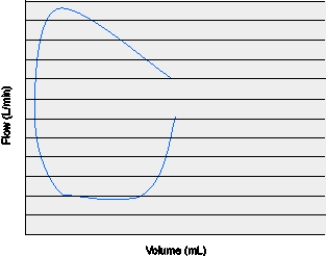 The flow-volume loop below is representative of which of the following conditions?   A)  System leak B)  Intrinsic PEEP C)  Inadequate flow D)  Active exhalation
