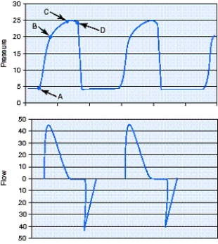 Identify the plateau pressure (Pₚₗₐₜₑₐᵤ) for the pressure-controlled continuous mandatory ventilation (PC-CMV) breaths in the figure.   A)  Point A B)  Point B C)  Point C D)  Point D