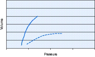 The static pressure-volume curve shown in the figure indicates the presence of which of the following?   A)  Atelectasis B)  Pneumonia C)  Pneumothorax D)  Bronchospasm