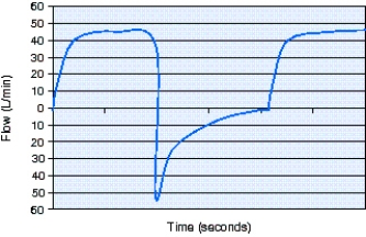 The peak inspiratory flow rate on the flow-time scalar below is which of the following?   A)  25 L/min B)  40 L/min C)  46 L/min D)  55 L/min
