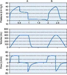 What is the trigger variable for the  A  breath shown in the figure below?   A)  Flow B)  Time C)  Pressure D)  Volume