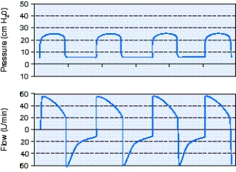 The ventilator graphics generated by mechanical ventilation with pressure-controlled continuous mandatory ventilation (PC-CMV) ,rate 18,peak inspiratory pressure (PIP) 25 cm H₂O,positive end-expiratory pressure (PEEP) 5 cm H₂O,are shown in the scalars below.Interpretation of these scalars reveals which of the following?   A)  The flow rate is set too high and should be reduced. B)  There is air trapping that could be due to a high respiratory rate. C)  The ventilator settings are appropriate and there are no problems. D)  There is a leak in the system that needs to be identified and corrected.