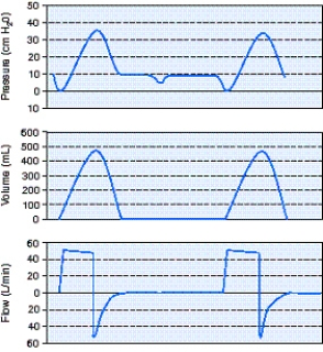Identify the improperly set ventilator parameter using the scalars shown below.   A)  Mode B)  Flow rate C)  Sensitivity D)  Tidal volume