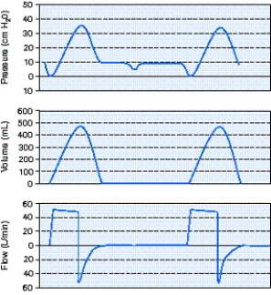 The respiratory therapist sees the following scalars on the screen of a ventilator providing support to a patient in the ICU.What action should the respiratory therapist take?   A)  Switch to the volume-controlled intermittent mandatory ventilation (VC-IMV)  mode. B)  Increase the flow rate to 60 L/min. C)  Decrease the sensitivity to 2 cm H₂O. D)  Increase the tidal volume to 550 mL.