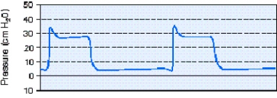 During pressure-controlled continuous mandatory ventilation (PC-CMV) the respiratory therapist observes the pressure-time scalar shown below.The most appropriate action to take is which of the following?   A)  Adjust the inspiratory time. B)  Increase the flow rate setting. C)  Adjust the inspiratory rise time control. D)  Increase the peak inspiratory pressure setting.