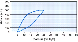 Calculate the static compliance using the information from the pressure-volume loop below.   A)  15 mL/cm H₂O B)  20 mL/cm H₂O C)  25 mL/cm H₂O D)  30 mL/cm H₂O