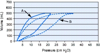 What is the cause of the change from pressure-volume loop A to pressure-volume loop B during volume-controlled continuous mandatory ventilation (VC-CMV) ?   A)  Decreased compliance B)  Increased compliance C)  Decreased airway resistance D)  Increased airway resistance