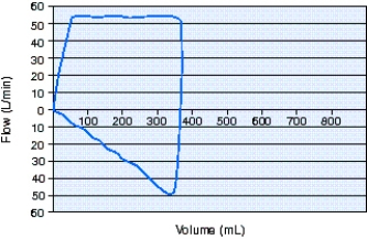 Identify the type of flow waveform the ventilator is delivering from the flow-volume loop below.   A)  Ascending ramp B)  Rectangular C)  Descending ramp D)  Exponential decay