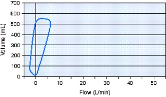 The type of breath shown in the flow-volume loop below is which of the following?   A)  Pressure support ventilation (PSV)  B)  Continuous positive airway pressure (CPAP)  C)  Pressure-controlled continuous mandatory ventilation (PC-CMV)  D)  Spontaneous without support