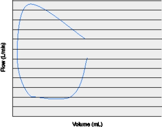 The flow-volume loop below is representative of which of the following conditions?   A)  System leak B)  Intrinsic PEEP C)  Inadequate flow D)  Active exhalation