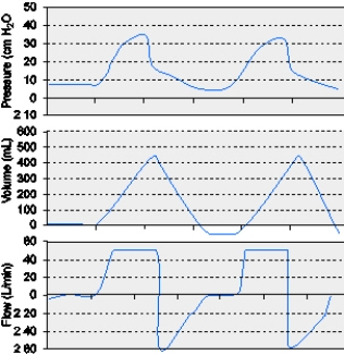 The graphic below for a patient receiving mechanical ventilation shows which of the following conditions?   A)  Leak in the circuit B)  Active inspiration C)  Active exhalation D)  Intrinsic PEEP