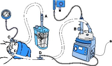 The pressure manometer should be placed at which point in the following CPAP system?   A)  Point A B)  Point B C)  Point C D)  Point D