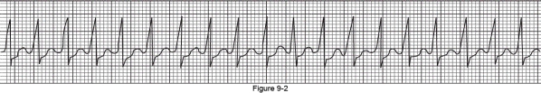What is the heart rate shown on the following electrocardiogram?   A)  150 B)  200 C)  250 D)  300