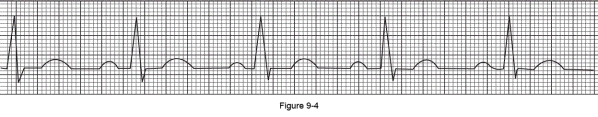 What is the heart rate depicted on the following electrocardiogram?   A)  60 B)  80 C)  100 D)  120