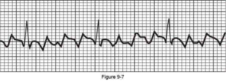 What are the atrial and ventricular rates for lead I in the following electrocardiogram?   Atrial Rate Ventricular Rate A)  75 225 B)  180 90 C)  300 75 D)  135 45