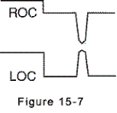 <strong>Electrooculogram electrodes are in place,and eye movement is to the left.The electrooculogram recording is shown by which of the following?</strong> A)   B)   C)   D)   <div style=padding-top: 35px> 