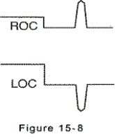<strong>Electrooculogram electrodes are in place,and eye movement is to the left.The electrooculogram recording is shown by which of the following?</strong> A)   B)   C)   D)   <div style=padding-top: 35px> 