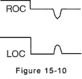 <strong>Electrooculogram electrodes are in place,and eye movement is to the left.The electrooculogram recording is shown by which of the following?</strong> A)   B)   C)   D)   <div style=padding-top: 35px> 