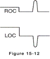 <strong>Electrooculogram electrodes are in place,and the eyes are looking up.The electrooculogram recording is shown by which of the following?</strong> A)   B)   C)   D)   <div style=padding-top: 35px> 