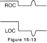 <strong>Electrooculogram electrodes are in place,and the eyes are looking up.The electrooculogram recording is shown by which of the following?</strong> A)   B)   C)   D)   <div style=padding-top: 35px> 