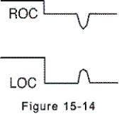 <strong>Electrooculogram electrodes are in place,and the eyes are looking up.The electrooculogram recording is shown by which of the following?</strong> A)   B)   C)   D)   <div style=padding-top: 35px> 