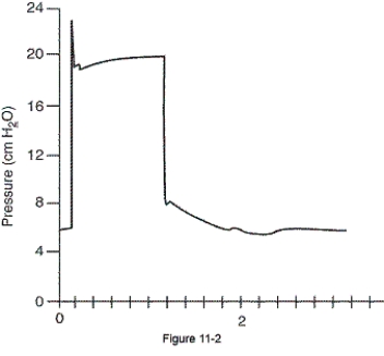<strong>The figure shows the pressure-time scalar for a pressure-support breath.To alleviate the problem depicted in this figure,the respiratory therapist should do which of the following?  </strong> A) Decrease the pressure setting B) Increase the inspiratory time C) Add inspiratory sloping D) Decrease the set volume <div style=padding-top: 35px> 