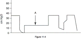 What does point A represent on the pressure-time scalar shown in the figure?   A)  Plateau pressure B)  Maximum safety pressure C)  Positive end-expiratory pressure D)  Auto-PEEP