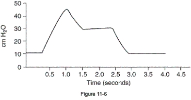 A patient being ventilated in the volume-controlled continuous mandatory ventilation mode had a measured tidal volume of 620 mL for the breath shown in the pressure-time scalar in the figure.What is the static compliance?   A)  18 mL/cm H₂O B)  21 mL/cm H₂O C)  31 mL/cm H₂O D)  62 mL/cm H₂O