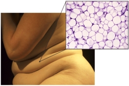 When weight is gained, how does it affect the tissue cells that are illustrated in this micrograph?   A)  The triglyceride droplets enlarge in size. B)  The triglyceride droplets increase in number. C)  The triglyceride droplets remain unchanged D)  The triglyceride droplets shrink in size.