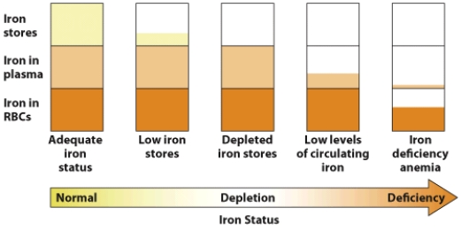 Based on this visual, discuss how anemia is the last stage of iron deficiency.   