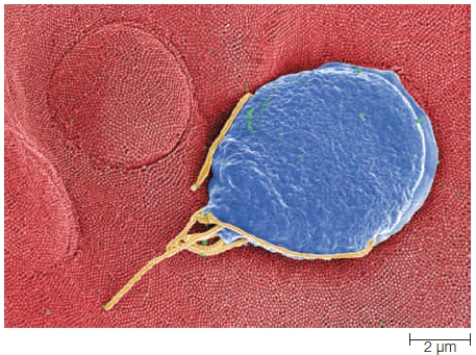 Figure 21.5    -The organism in the accompanying figure belongs to which group? A)  ​excavates B)  ​alveolates C)  ​stramenopiles D)  ​green algae E)  ​amoebozoans 