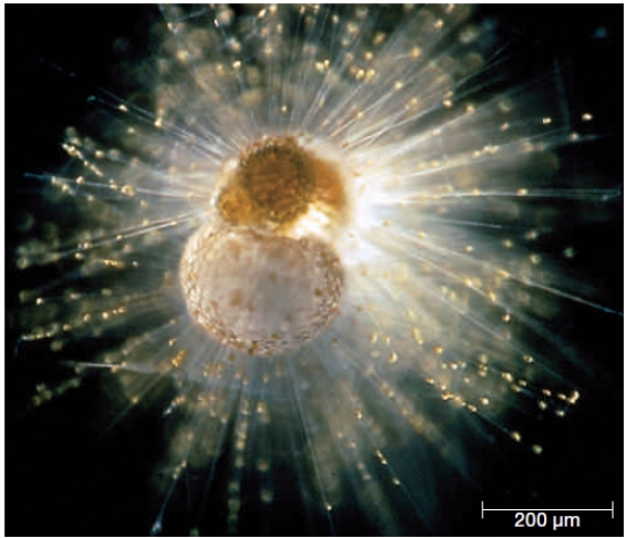 Figure 21.9    -The organism in the accompanying figure belongs to which group?​ A)  ​excavates B)  ​alveolates C)  ​stramenopiles D)  ​green algae E)  rhizarians 