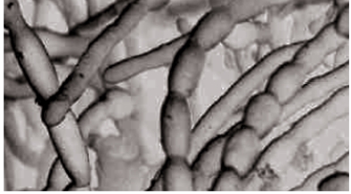 <strong>Figure 23.3 Which statement best describes the value of fungi in the environment?</strong> A) Fungi fix nitrogen from the air for use by plants. B) Fungi trap sunlight energy in the form of carbohydrates. C) Fungi release elements from organic matter. D) Fungi enrich the soil by decreasing the rate of decay of organic matter. E) Fungi remove toxic metals from the soil.