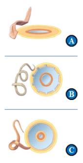Figure 24.4    -In the accompanying figure, a(n)  ____ has body plan B. A)  ​Pseudocoelomate B)  ​eucoelomate C)  ​radially symmetrical D)  ​echinoderm E)  ​acoelomate 