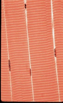 Figure 31.10A    -The accompanying figure is a micrograph of what kind of tissue?​ A)  ​cardiac muscle B)  ​skeletal muscle C)  ​smooth muscle D)  ​cartilage E)  ​dense connective 